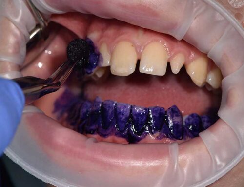 la polvere che bella invenzione